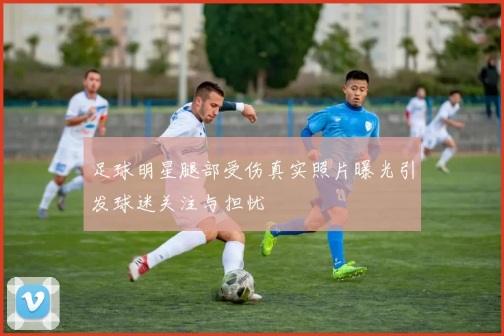 足球明星腿部受伤真实照片曝光引发球迷关注与担忧